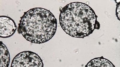 Koaservat Nedir? İlkin Koaservat Yapıları Nasıl Oluşmuştur?