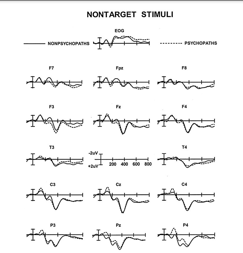 Şekil 6: Psikopatlar ve Psikopat Olmayanlar için hedef olmayan uyaranlara yönelik büyük ortalamalı ERP'lerin karşılaştırılması. EOG, elektrookülogram.