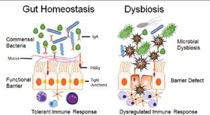 Link Found Between Gut Microbiota, Metabolic Syndrome, And Breast Cancer