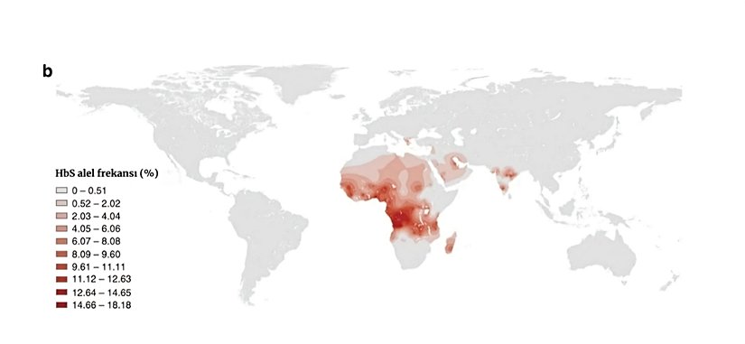 Şekil 25. Orak Hücre hemoglobin alelinin coğrafi görülme sıklığı.