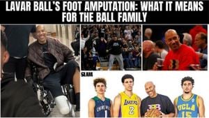 LaVar Ball Faces Health Challenge After Foot Amputation