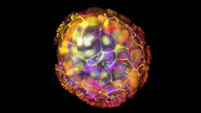 İnsan Hücrelerinden Yapılmış Küçük Robotlar Hasarlı Dokuları İyileştirebiliyor!