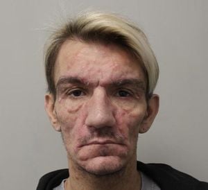 London Rapist Jailed After HIV Transmission Scandal