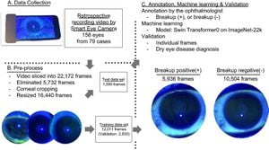 AI Model CorneAI Boosts Ophthalmology Diagnosis Accuracy