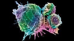 Kanımızdaki "Seri Katiller": T Hücreleri ve Yaptıkları "Katliamın" Anlık Görüntüleri!