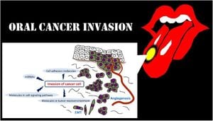 RAC1 Overexpression Linked To Tongue Cancer Progression