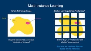 Novel Multi-instance Learning Framework Boosts Depression Detection