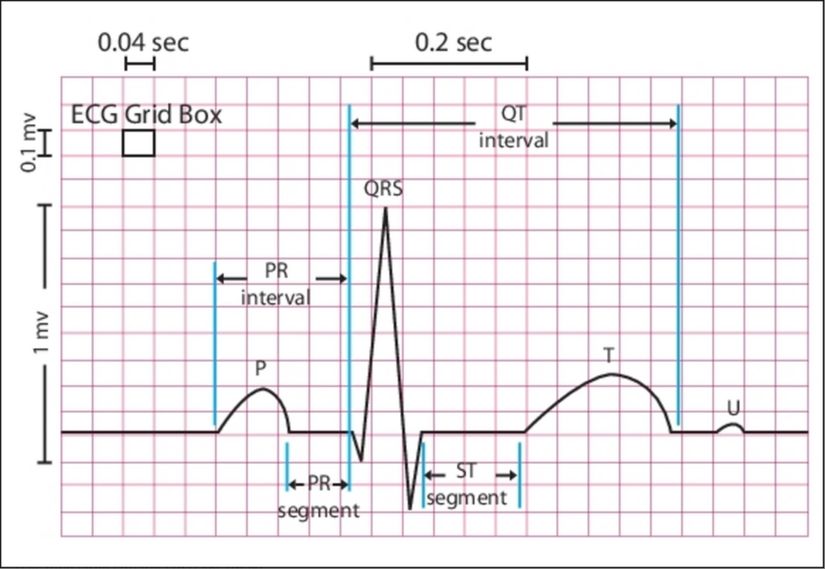 Ekg