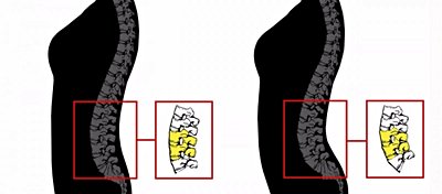 Erkeklerin Dişilerde Belli Vücut Şekillerini Seçme Nedenlerinin Evrimsel Kökenleri