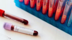 Kan Grupları: Kanımızda Neden Karşıt Grupların Antikorları Var?