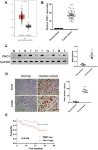 PNO1 enhances ovarian cancer cell growth, invasion, and stemness via activating the AKT/Wnt/β-catenin pathway - Scientific Reports