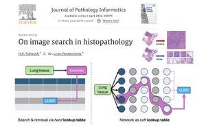 Foundation Models Improve Histopathology Image Retrieval Accuracy