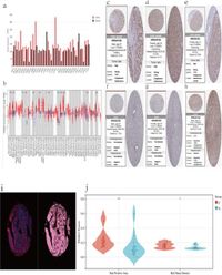 Expression of PSMD2 gene in hepatocellular carcinoma and its correlation with immune checkpoints and prognosis - Scientific Reports