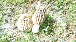 Kuzugöbeğini Bulmaya İnovasyon