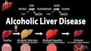 New Insights On BRISC Role In Alcohol-Induced Liver Injury