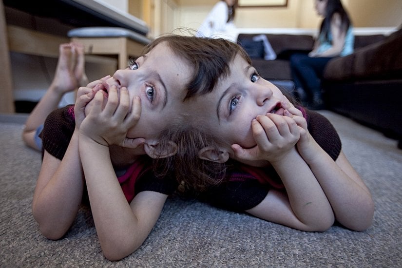Fotoğrafa baktığınız yönde sol taraftaki ikiz "Tatiana Hogan", sağ taraftaki ikiz "Krista Hogan"dır.