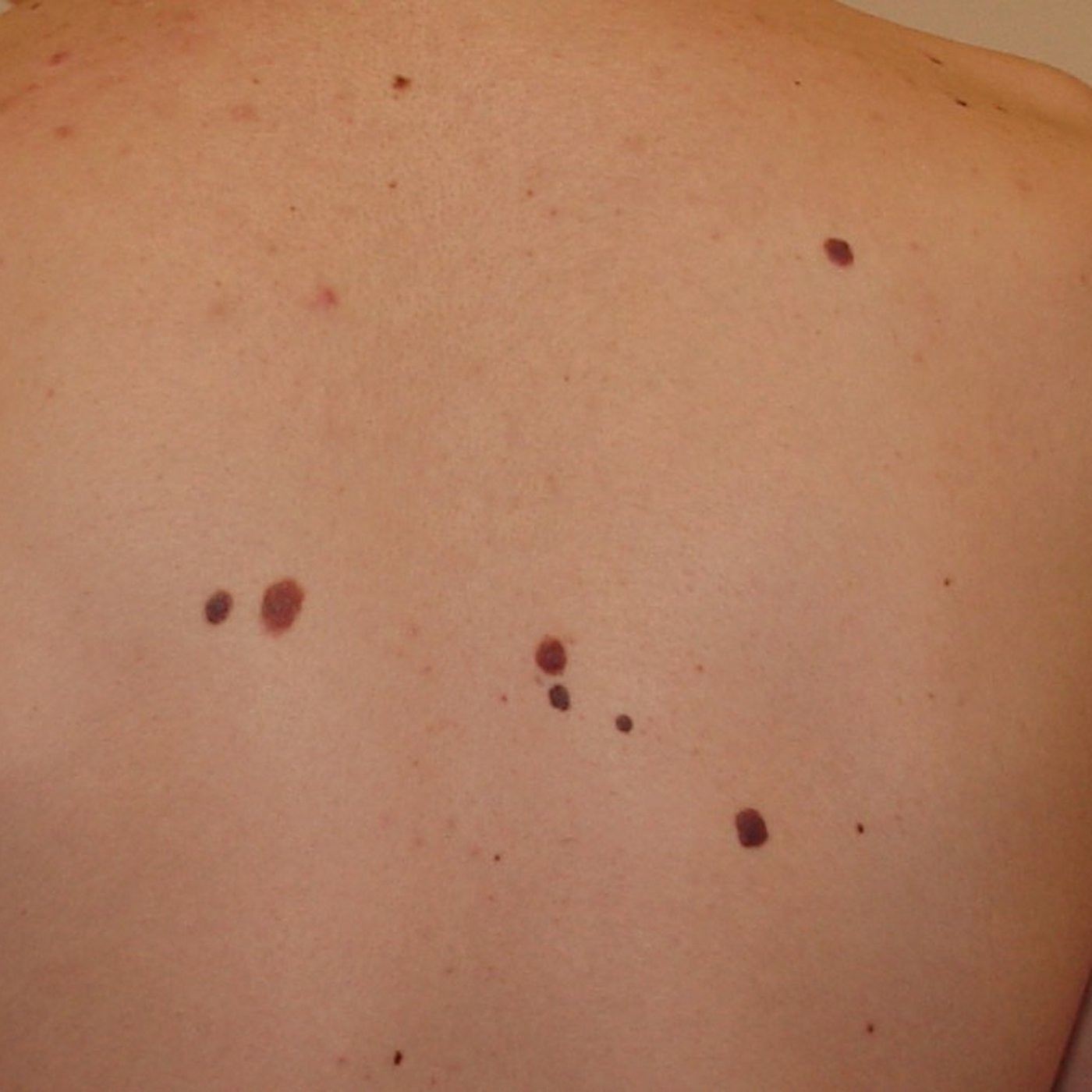 Evrim Ağacı ile Bilime Dair Her Şey!