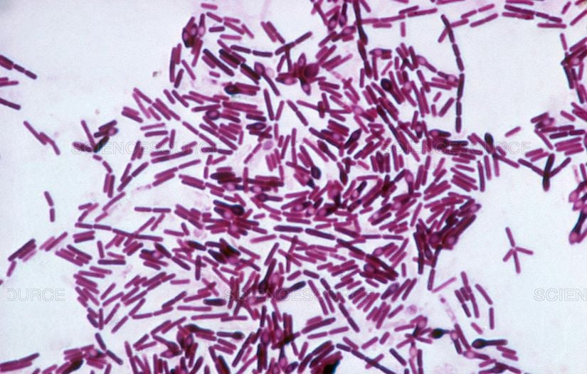 C.botulinum'un ışık mikroskopu altında görünümü