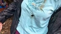 Zwei deutsche Touristen von Blitz in die Brust getroffen
