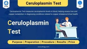 Salivary Test Revolutionizes Diagnosis Of Wilson's Disease