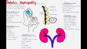 Research Uncovers SIRT2 As Key Target For Diabetic Nephropathy