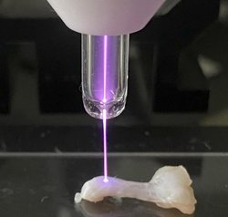 Aşil Tendonu Onarımında Yeni Yöntem