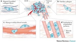 Electric Fields Disrupt Breast Cancer Cell Movement Inside Microchannels