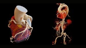 Revolutionary 3D Imaging Method Reconstructs Whole Hearts