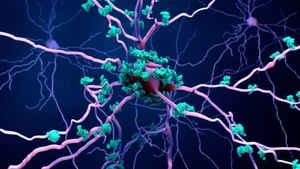 Unraveling Neuroinflammation's Impact On Parkinson's Disease