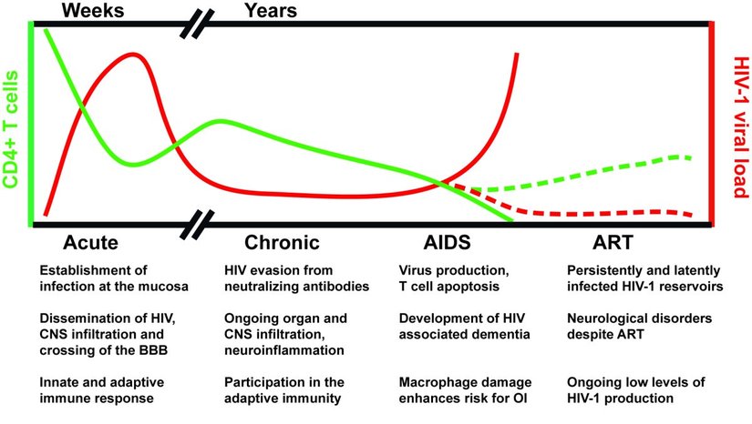 AIDS hastalığının gelişimi sırasında, HIV'in ilk bulaşmasından sonraki 4 temel hastalık fazında meydana gelen değişimleri gösteren bir grafik. İlk evrede HIV vücuda giriyor ve vücut-beyin bariyerini aşıyor. Hemen savunma sistemi devreye giriyor. Ancak yeterince güçlü olamadığı için HIV hızla yayılmayı sürdürür. Sonrasında geçici olarak bağışıklık sistemi üstün gelir ve HIV kronik faza girerek sabit bir seyirde devam eder. Bu sırada çeşitli organlara bulaşmayı sürdürür. AIDS'in semptomları belirmeye başlar. Birey enerjisini yitirmeye başlar, kilo kaybı olur, sık sık ateş ve terleme görülür, mantar enfeksiyonları başlar, deri sıklıkla kızarır, kısa dönem hafıza kayıpları başlar, ağızda, cinsel organlarda ve anüste sivilceler oluşmaya başlar. Nihayetinde seri virüs üretimi başlar ve savunma hücrelerimiz ölmeye başlar. Hastalığın seyri ilerledikçe daha ağır semptomlar oluşur: öksürük ve nefes darlığı, nöbetler, koordinasyon bozukluğu, yutkunma güçlüğü, kafa karışıklığı, sürekli ishal hali, ateş, görüş kaybı, mide bulantısı ve mide krampları, aşırı bitkinlik, aşırı baş ağrısı, koma, vb.