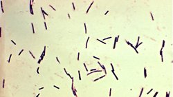 Neden az pişmiş tavuk yok?