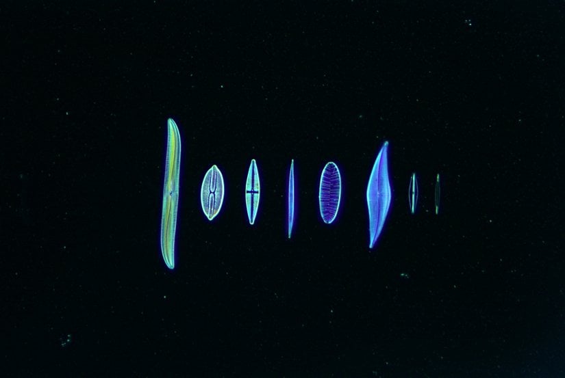 Diatomların karanlık alan mikroskobu görüntüleri (x100)