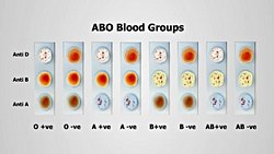 İNSAN KAN GRUPLARI VE KLİNİK ÖNEMİ