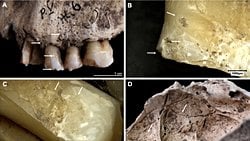 Ukrayna'da Taş Devri İnsanlarının Yangında Öldüğü Ortaya Çıktı!