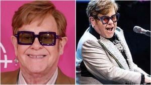 Elton John Loses Eyesight Due To Severe Infection