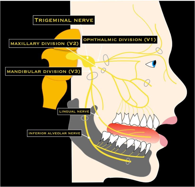 Beyin ve yüz arasındaki sinirsel bağlantıyı sağlayan üçlü sinir (İng: trigeminal nerve). Damaktan alınan soğuk uyarana tepki olarak kan akışı beyin ön arterine yönlendirilir ve kanın bu hücumu üzerine beynin frontal lobunda acı hissedilir.