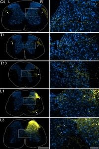 Anatomical characterisation of somatostatin-expressing neurons belonging to the anterolateral system - Scientific Reports