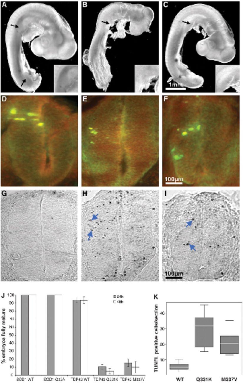 Mutant TDP-43 proteininin tavuk embriyosu nöral tübünün gelişimine etkisi.