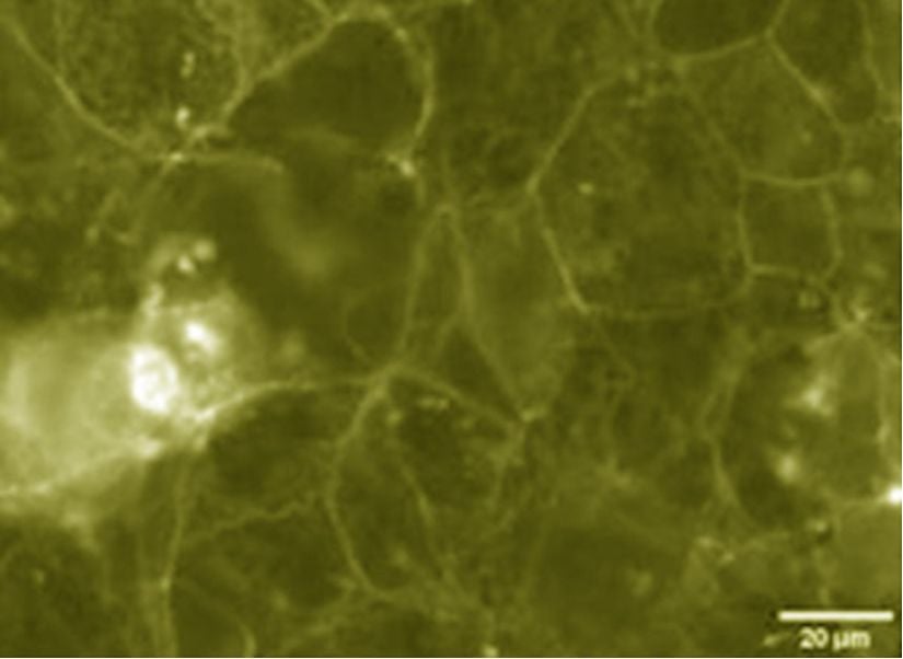 Rhodococcus cinsinin T091-5 suşu.