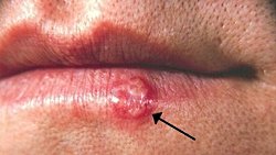 Virüsler: Düşmanımın Düşmanı Dostumdur!