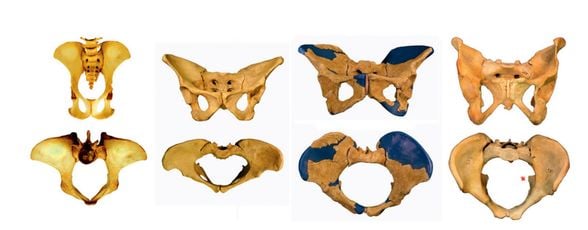 Soldan sağa: Şempanze, Australopithecus afarensis (Lucy), Homo erectus ve Homo sapiens. Bizdeki pelvis açıklığının hepsinden geniş olduğuna dikkat ediniz. Bu, vücut büyüklüğüne oransal olarak da en geniş kalça açıklığı.