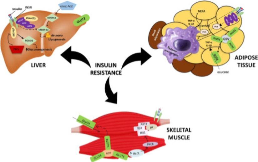 Egzersiz ve insülin direnci