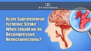 New Tool Could Predict Surgery Needs For Malignant Strokes