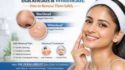 Blackheads and Whiteheads: How to Remove Them Safely