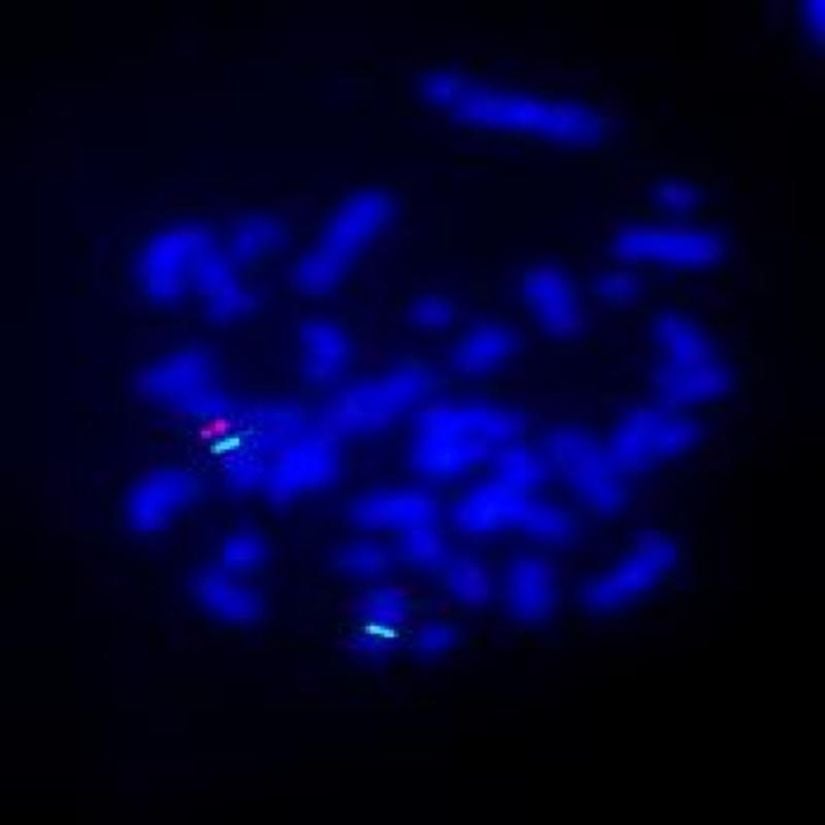 In situ Hibridizasyon tekniği ile incelenen genler. İki yeşil, 2 sentromer X kromozomunu ve bir kırmızı Xpterdeki (X kromozomunun kısa kolundaki terminal bölge.) SRY'yi  gösterir. Sarı (üst üste gelen kırmızı ve yeşil) noktanın olmaması, Y kromozomu sentromerlerinin olmadığını gösterir.