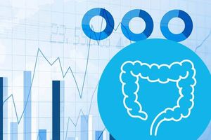 Rising Colon Cancer Rates Among Those Under 50 Alarm Researchers
