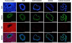 Innovative Organoid Models Reveal Hormonal Impact On Endometriosis