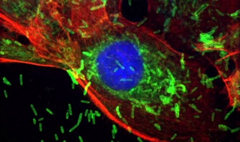 Ağızda bulunan F. nucleatum bakterisi, laboratuvar ortamında bir insan meme kanseri hücresinin içine giriyor. Bu hücre, bakterinin yerleşmesine yatkın hale getirebilecek bir mutasyon taşıyor.