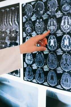 Satın alma eylemi sırasında dopamin salgısı  artıyorsa, bu artışın şiddeti veya miktarı hakkında bir sayısal değerlendirme mümkün müdür?