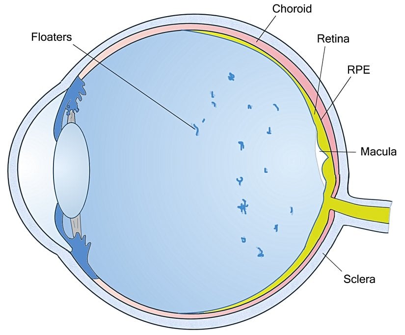 Yüzer şekillerin gözünüzün tam olarak neresinde olduğunu gösteren bir şekil.